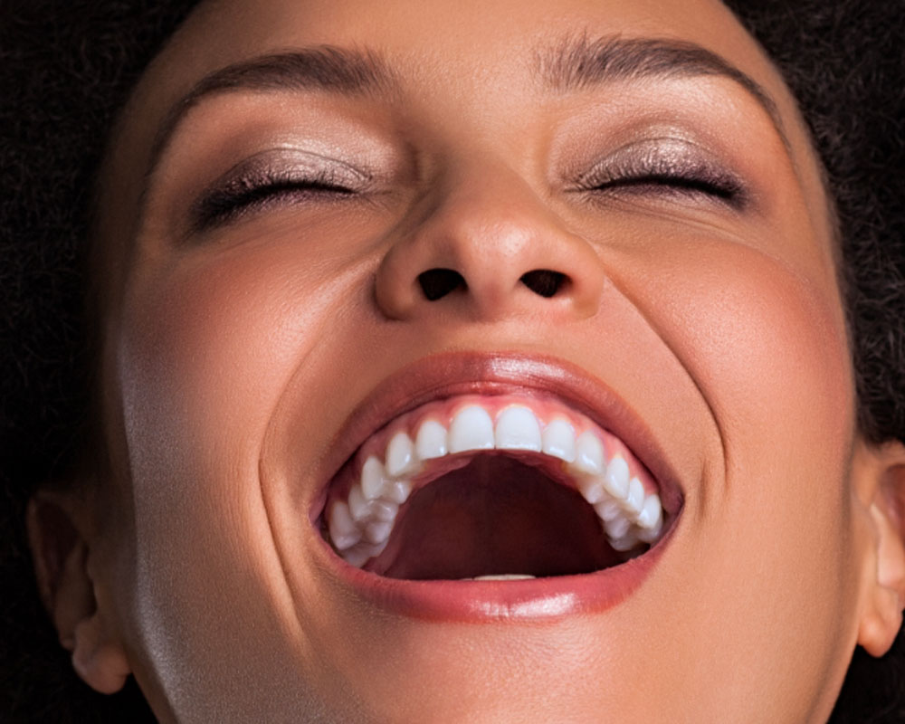 Lentes de Contato Dental em Braganca Paulista