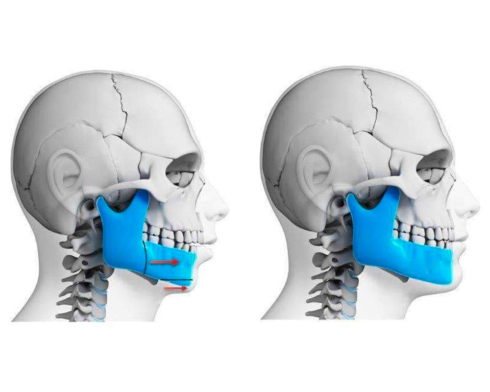Cirurgia Bucomaxilofacial em Braganca Paulista